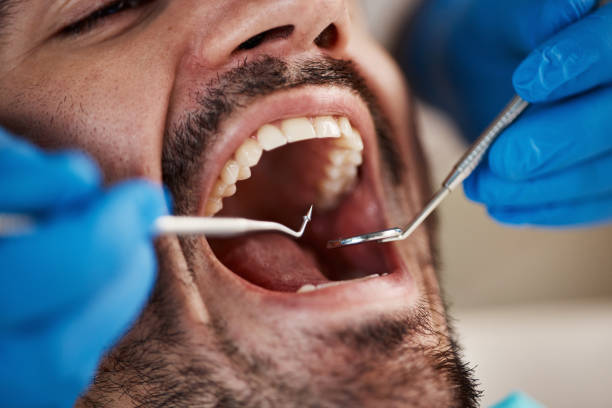 Best Tooth Infection Emergency Dentist  in Mebane, NC